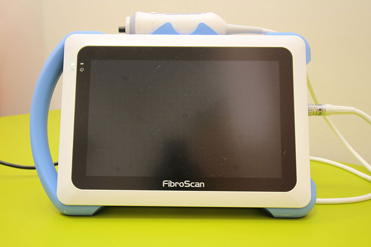 フィブロスキャン