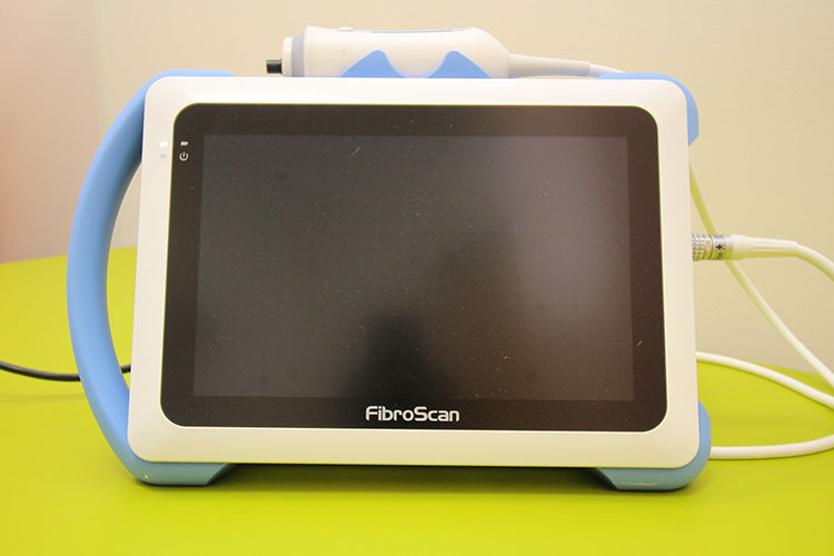 フィブロスキャン画像