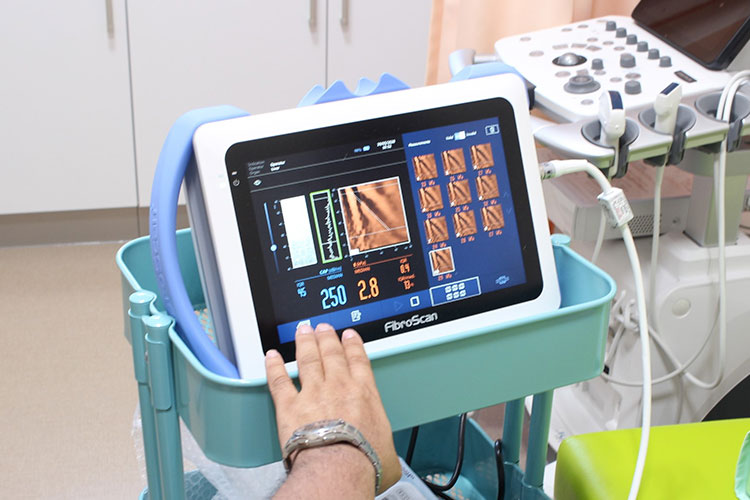 フィブロスキャン画像2